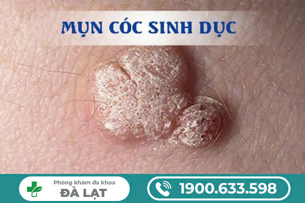 Hình ảnh minh họa